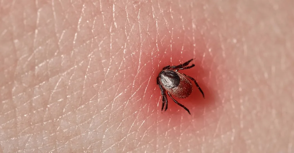 Symptoms Of Lyme Disease From A Tick Bite